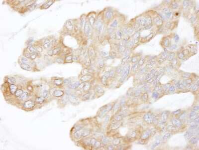 Immunohistochemistry-Paraffin: CIP2A Antibody [NB100-74663]