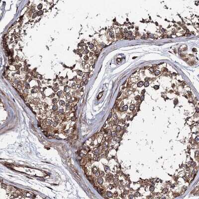 Immunohistochemistry-Paraffin: CIP2A Antibody [NBP2-48710]