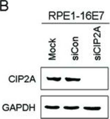 Knockdown Validated: CIP2A Antibody [NB100-68264]