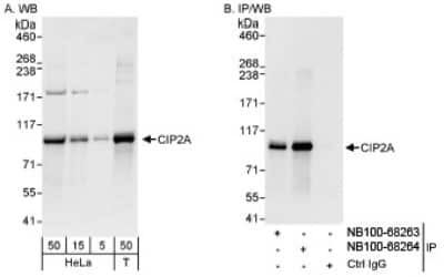 Western Blot: CIP2A Antibody [NB100-68264]