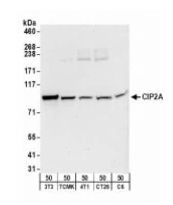 Western Blot: CIP2A Antibody [NB100-68264]