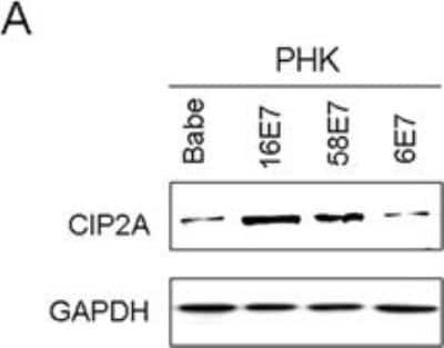 Western Blot: CIP2A Antibody [NB100-68264]