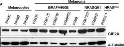 Western Blot: CIP2A Antibody [NB100-74663]