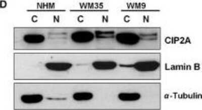 Western Blot: CIP2A Antibody [NB100-74663]
