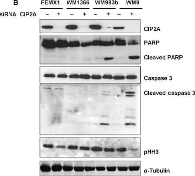 Western Blot: CIP2A Antibody [NB100-74663]