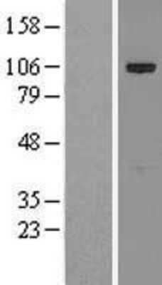 Western Blot: CIP2A Overexpression Lysate [NBL1-12266]