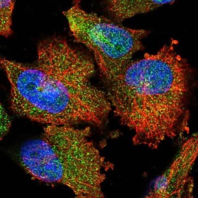 Immunocytochemistry/ Immunofluorescence: CIPAR-1 Antibody [NBP1-85610]