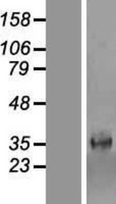 Western Blot: CIPAR-1 Overexpression Lysate [NBP2-07175]