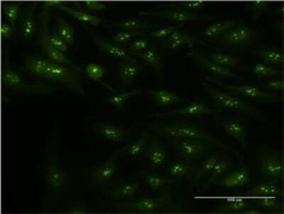 Immunocytochemistry/ Immunofluorescence: CIRBP Antibody (1C9) [H00001153-M03]