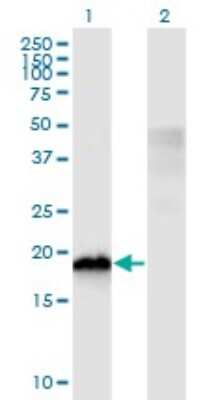 Western Blot: CIRBP Antibody (1C9) [H00001153-M03]