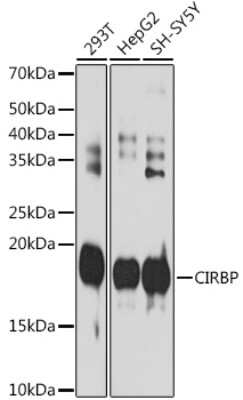 Western Blot: CIRBP Antibody (3V9S7) [NBP3-15745]