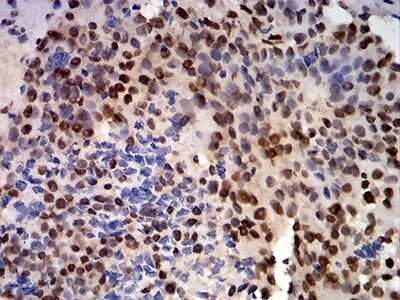 Immunohistochemistry: CIRBP Antibody (6E12B3) - BSA Free [NBP2-61734]