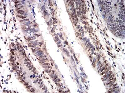 Immunohistochemistry: CIRBP Antibody (6E12B3) - BSA Free [NBP2-61734]