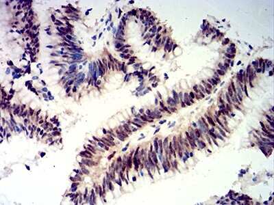 Immunohistochemistry: CIRBP Antibody (6E12D5) - BSA Free [NBP2-61735]