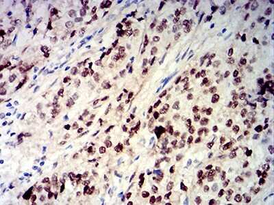 Immunohistochemistry: CIRBP Antibody (6E12D5) - BSA Free [NBP2-61735]