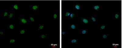 Immunocytochemistry/ Immunofluorescence: CIRBP Antibody [NBP2-15905]