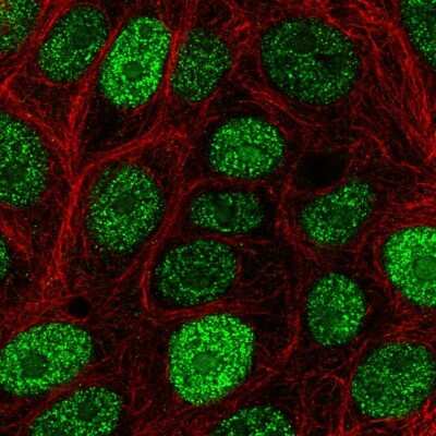 Immunocytochemistry/ Immunofluorescence: CIRBP Antibody [NBP2-55893]