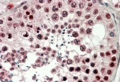 Immunohistochemistry-Paraffin: CIRBP Antibody [NBP1-52067]