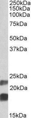 Western Blot: CIRBP Antibody [NBP1-52066]