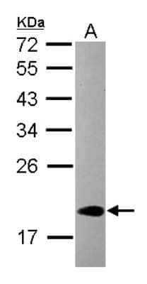 Western Blot: CIRBP Antibody [NBP2-15905]