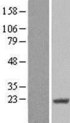 Western Blot: CIRBP Overexpression Lysate [NBL1-09212]