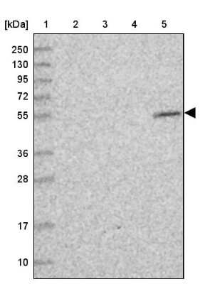 Western Blot: CIRH1A Antibody [NBP1-91789]