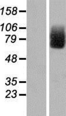 Western Blot: CIRH1A Overexpression Lysate [NBP2-05966]