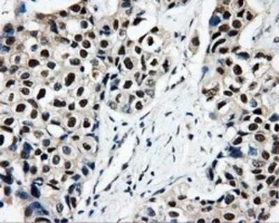 Immunohistochemistry: CISD1 Antibody (OTI4G3) - Azide and BSA Free [NBP2-72026]