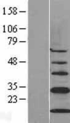 Western Blot: CISD1 Overexpression Lysate [NBL1-09214]