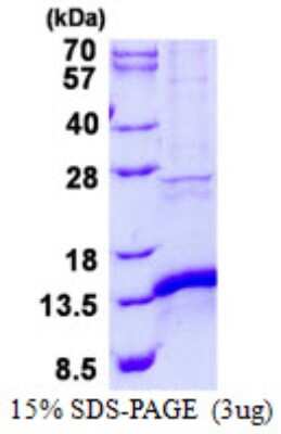 SDS-PAGE: Recombinant Human CISD1 His Protein [NBP2-22762]