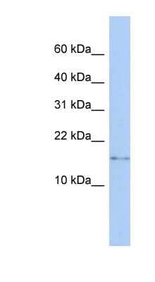 Western Blot: CISD2 Antibody [NBP1-59676]