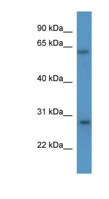 Western Blot: CISH/CIS-1 Antibody [NBP1-79513]