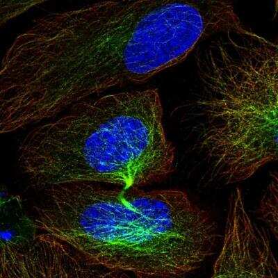 Immunocytochemistry/ Immunofluorescence: CISH/CIS-1 Antibody [NBP2-38474]