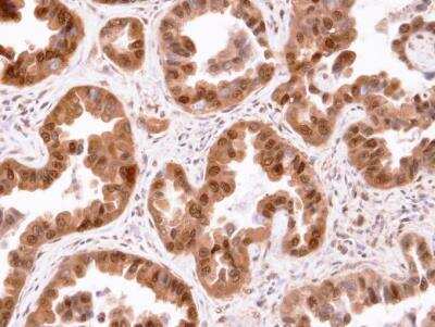 Immunohistochemistry-Paraffin: CISH/CIS-1 Antibody [NBP1-30943]