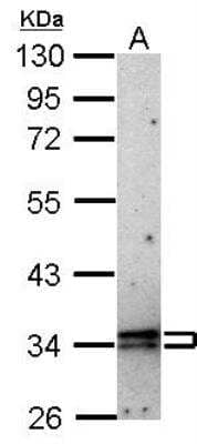 Western Blot: CISH/CIS-1 Antibody [NBP1-30943]