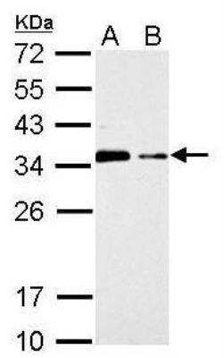 Western Blot: CISH/CIS-1 Antibody [NBP1-30943]