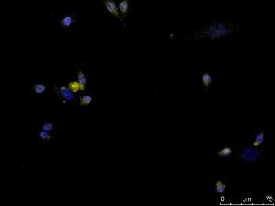 Immunocytochemistry/ Immunofluorescence: CITED1 Antibody (5H6) [H00004435-M03]