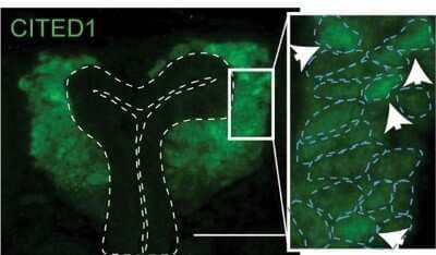 Immunohistochemistry: CITED1 Antibody (5H6) [H00004435-M03]