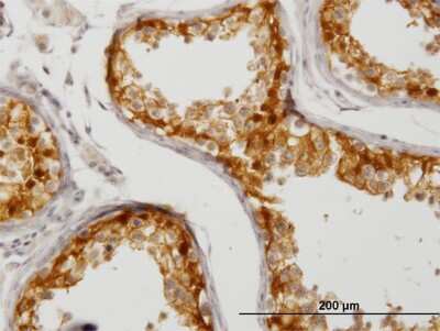 Immunohistochemistry-Paraffin: CITED1 Antibody (5H6) [H00004435-M03]