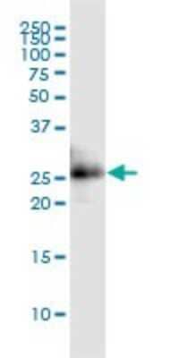 Western Blot: CITED1 Antibody (6C1) [H00004435-M02]