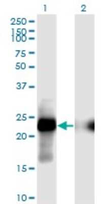 Western Blot: CITED1 Antibody (6C1) [H00004435-M02]