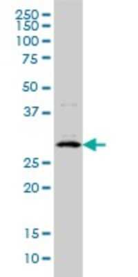 Western Blot: CITED1 Antibody (6G8) [H00004435-M01]