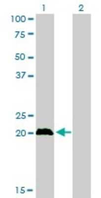 Western Blot: CITED1 Antibody (6G8) [H00004435-M01]