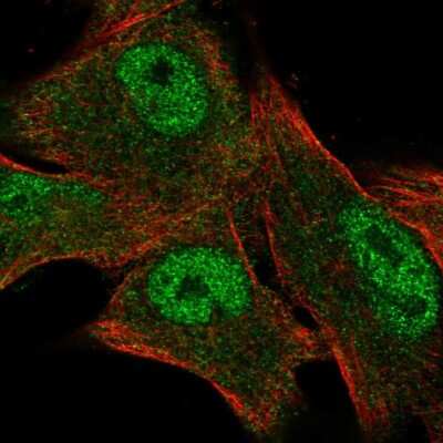 Immunocytochemistry/ Immunofluorescence: CITED1 Antibody [NBP2-55317]