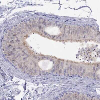 Immunohistochemistry-Paraffin: CITED1 Antibody [NBP2-55317]