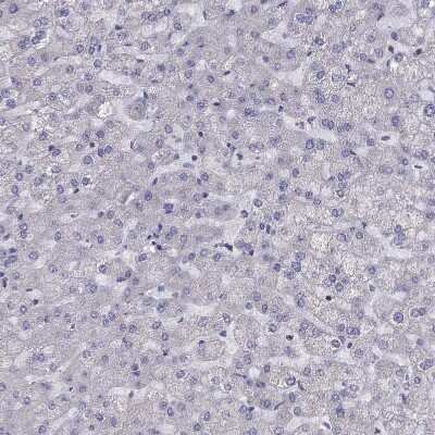 Immunohistochemistry-Paraffin: CITED1 Antibody [NBP2-55317]