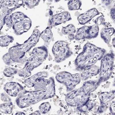 Immunohistochemistry-Paraffin: CITED1 Antibody [NBP2-55317]