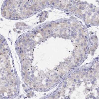 Immunohistochemistry-Paraffin: CITED1 Antibody [NBP2-55317]