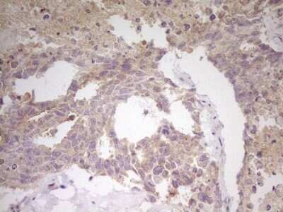 Immunohistochemistry: CITED1 Antibody (OTI3C12) - Azide and BSA Free [NBP2-71199]