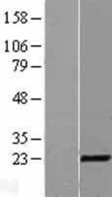 Western Blot: CITED1 Overexpression Lysate [NBL1-09217]